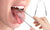 Stainless Steel Tongue Scraper